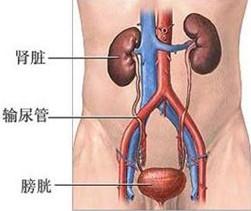 膀胱炎